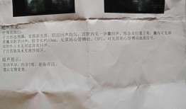 最容易怀男孩的方法，怎样怀男孩的科学方法